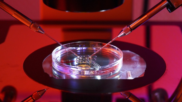 Ansicht unter einem Mikroskop wie mit Hilfe einer Glasnadel ein weibliches Ei künstlich mit männlichen Samen befruchtet wird.