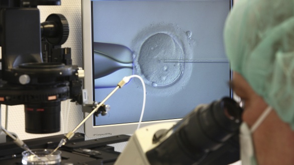 Ansicht unter einem Mikroskop wie mit Hilfe einer Glasnadel ein weibliches Ei künstlich mit männlichen Samen befruchtet wird.